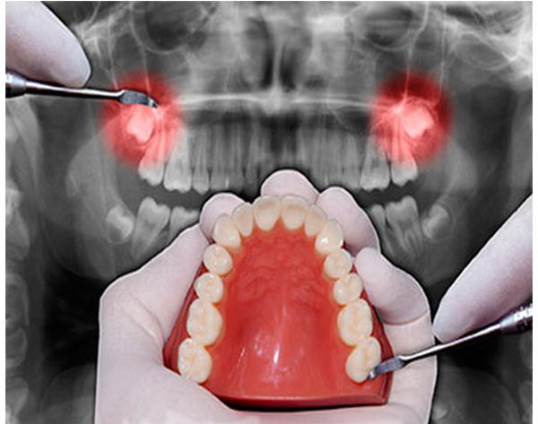 Equipamento de Cirurgia Dentária