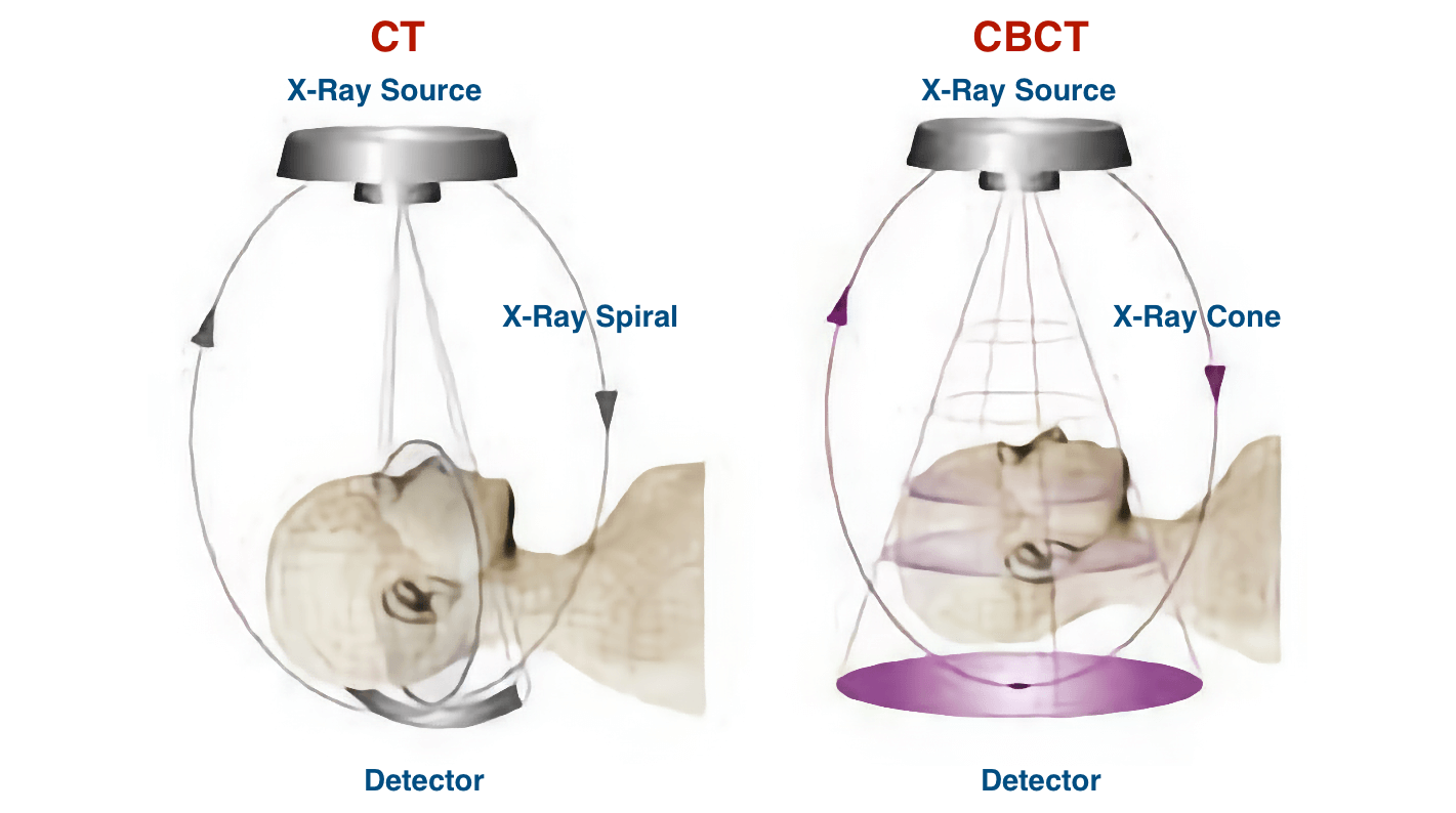 Differences between CT and CBCT