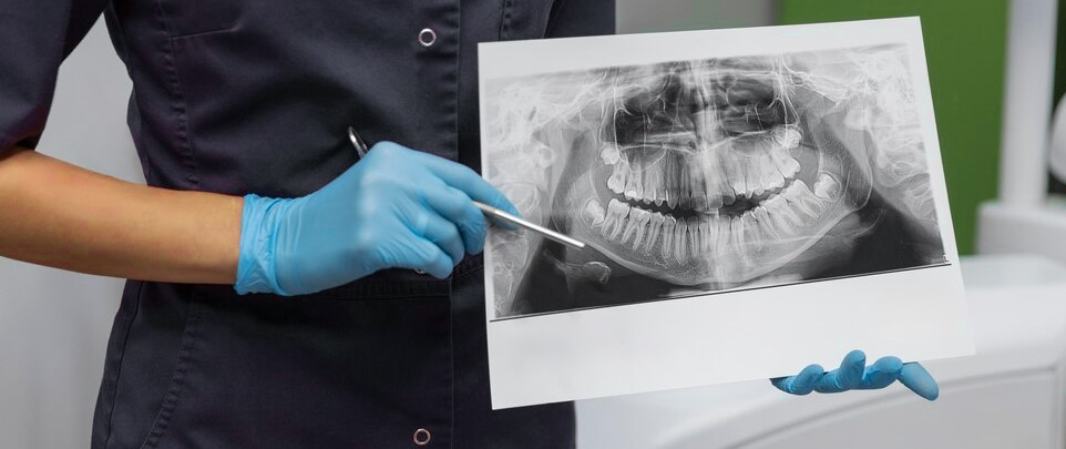 Dental X-rays