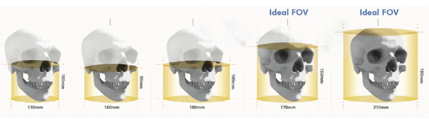 Different types of FOV in CBCT