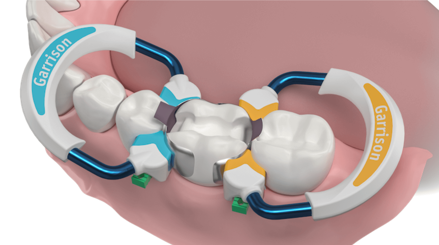 Preformed Dental Matrices