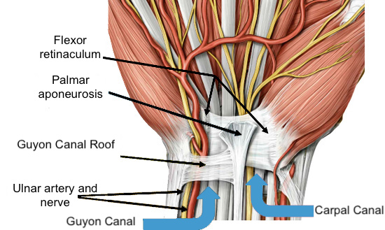 Guyon's Canal Syndrome