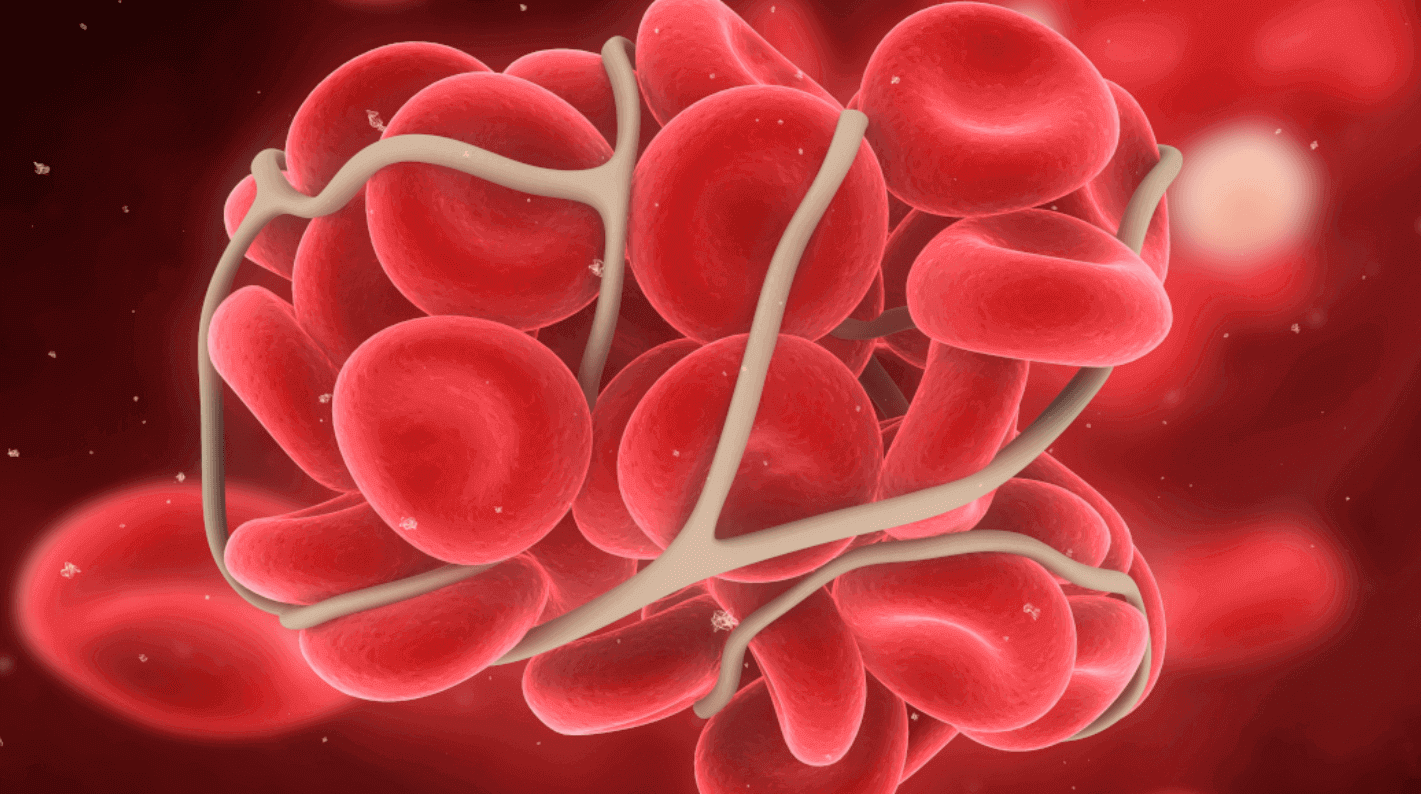 Haemostasis in dentistry