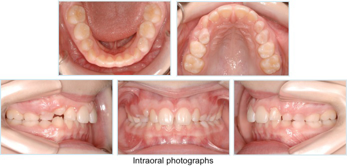 Intraoral photographyl