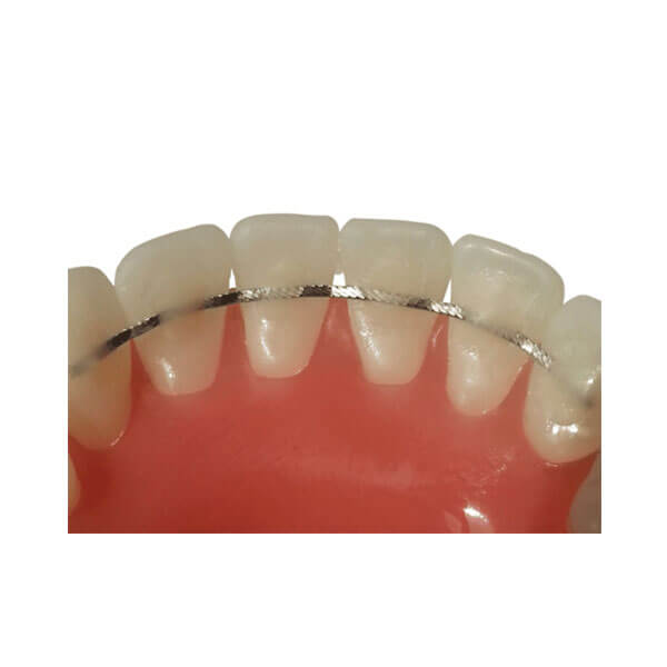 2 Pièces Attelle Linguale Orthodontique Universelle 1,2 Mm - Neuves, Pour Dentaire