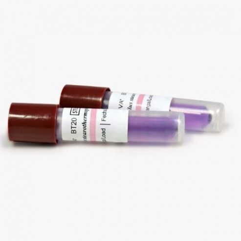 BT20 Biological Indicator Test (100 units) Img: 202303251