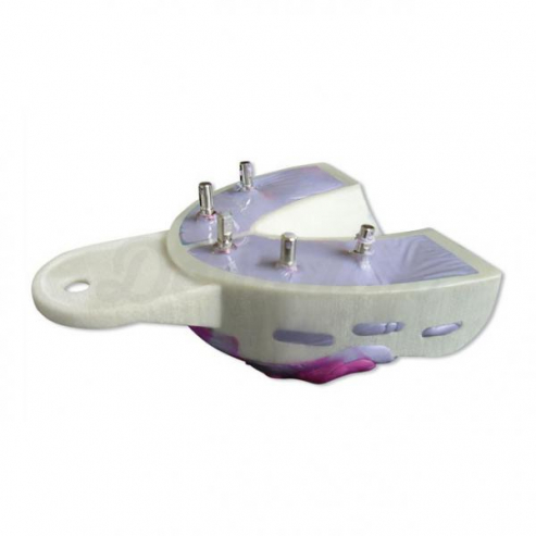 Miratray implant - Trays w/ Implants with printing foil (6units) - Intro Kit (6ud) Img: 201905181 Miratray implant - Trays w/ Implants with printing foil (6units) - Intro Kit (6ud) Img: 201905181