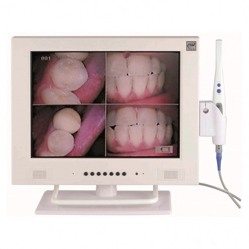 Intraoral camera with autofocus system (1 pc.) Img: 202302251