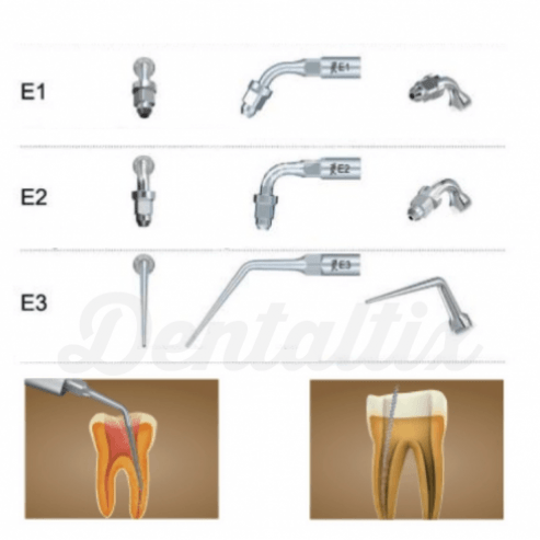 Insert E ultrasonic endodontic p / EMS (1pc) - E3 Img: 201905251