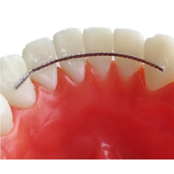 Twisted Retaining Wire (10 pcs) Astar Orthodontics