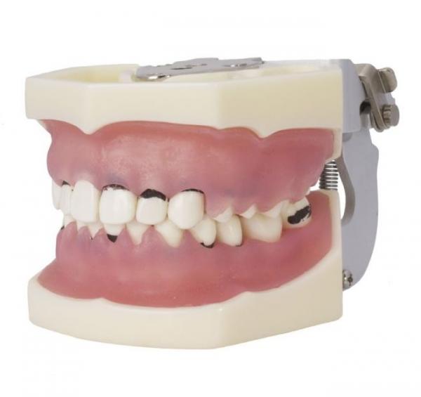 Type of articulated periodontics Img: 202008291