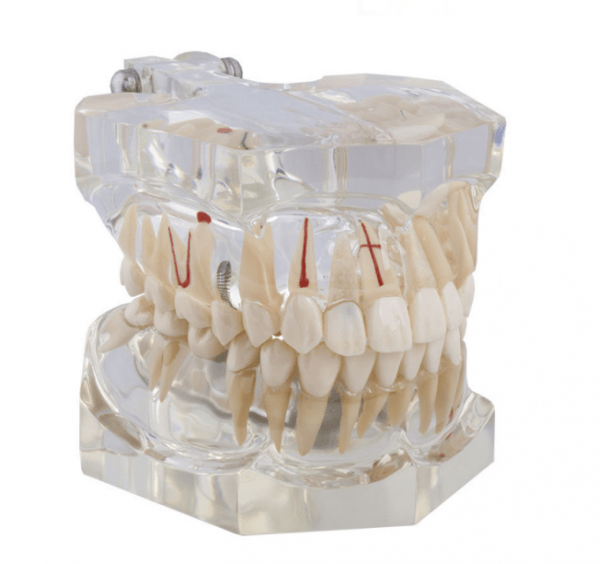 Macromodel with Complete Pathology-1 macromodel Img: 202008291