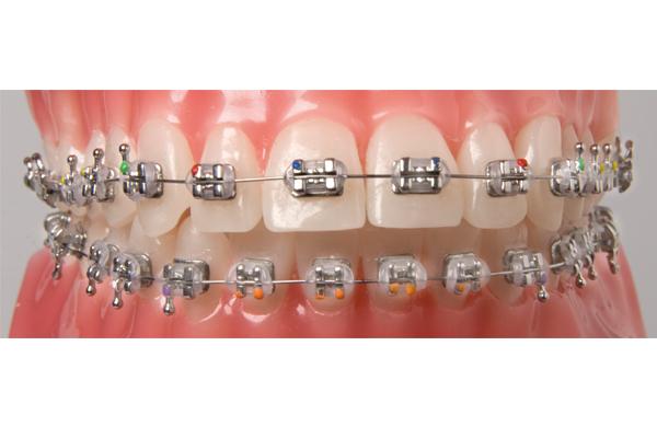 BRACKETS AGILE ROTH 022 5-5 SUP / INF 1 CASE Img: 201807031