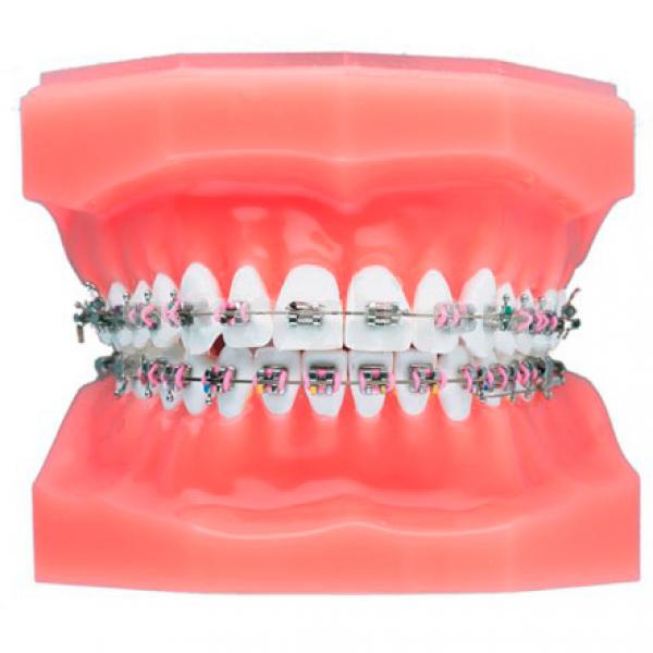 ELITE ROTH MINI TWIN BRACKETS 022 (5u.) VARIOUS