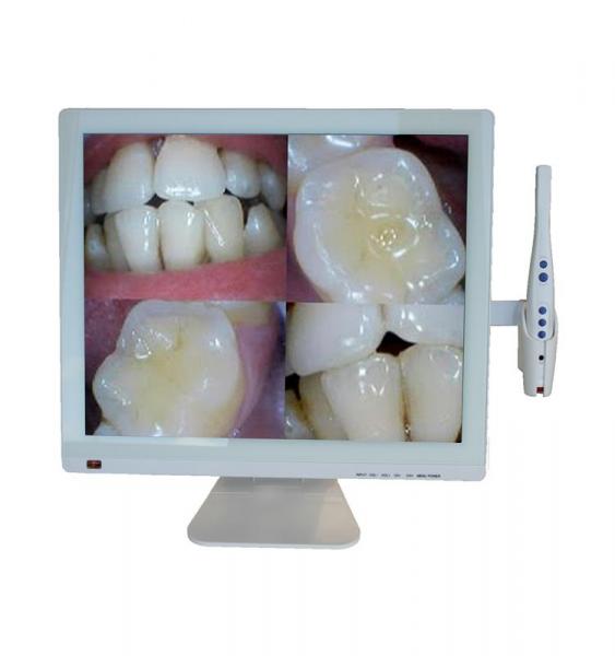 Intraoral camera M998A + LED display 19 TECHNOFLUX