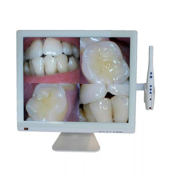 Intraoral camera M998A + LED display 19-Camera Img: 202001041