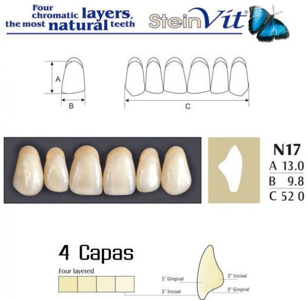 TEETH STEINVIT N17 UP A1 Img: 201811031