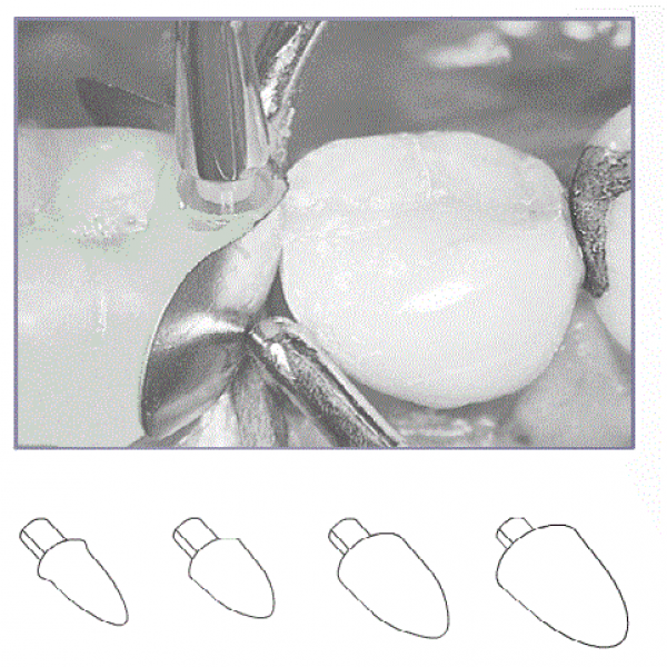 CONTACT FORMERS Img: 201905111
