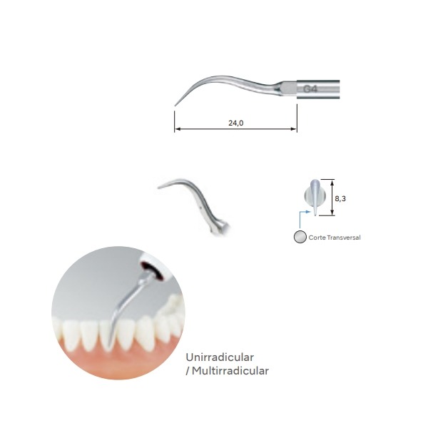 G4 Ultrasound Points Img: 202304151