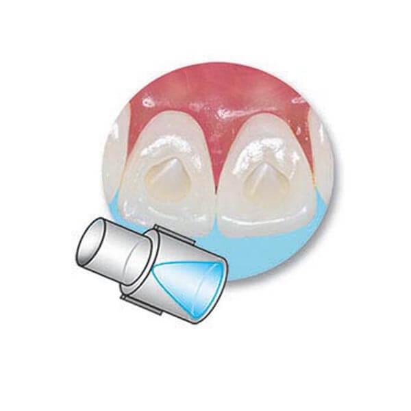 Mini Mould for Habit Monitoring - Habit monitoring Img: 202102271
