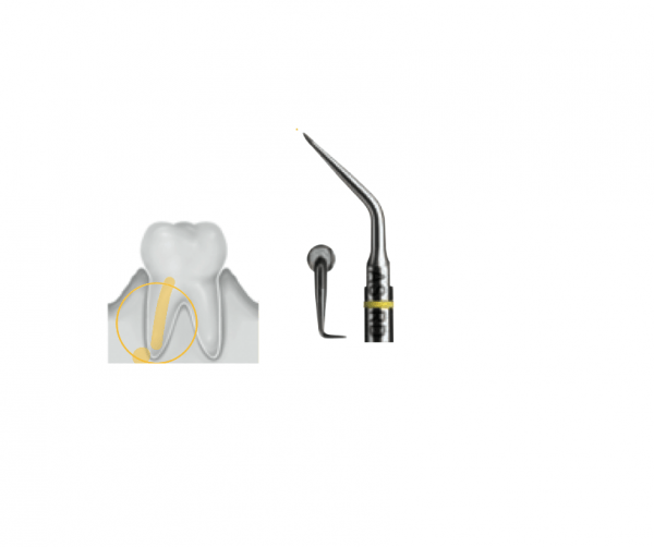 Ultrasonic ASLD Insert Right Angulation for Apical Surgery (1 pcs.) Img: 201907271