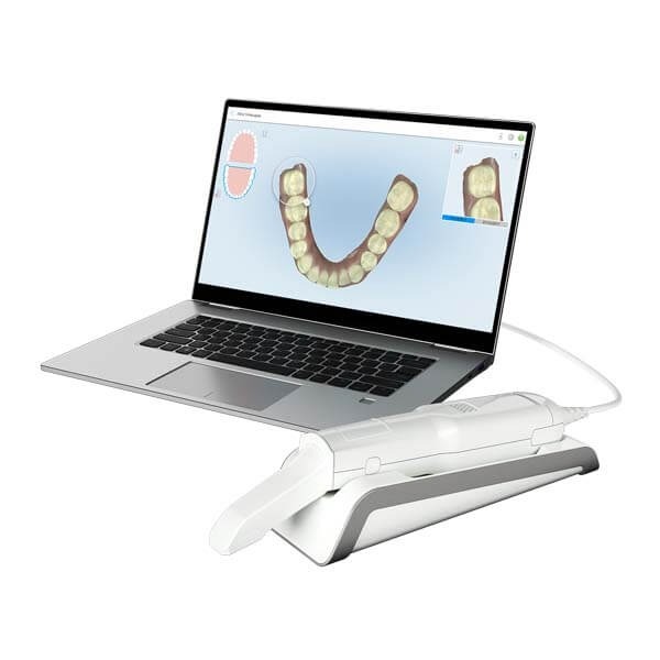 iTero Element Flex Portable Scanner iTero