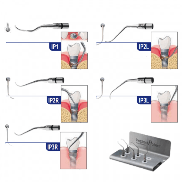 Titanium Implant Protect Insert Kit for Satelec Acteon SATELEC