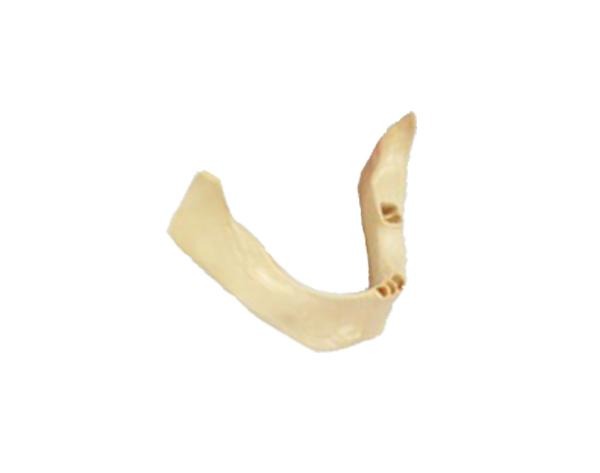 Edentulous Jaw with Simulated Nerves - A-J K Alveoli exposed Img: 202107101