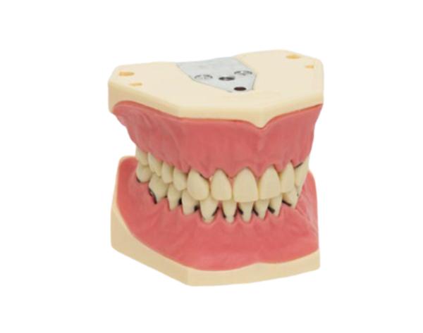 A-PZ: Periodontics Model with Screw-Retained Teeth Img: 202107101