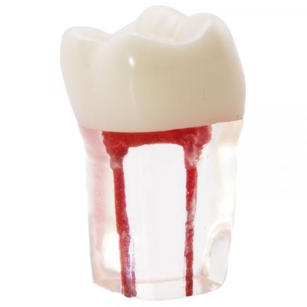 MOLAR WITH RADICULAR LEADS FOR STUDENTS Img: 202202121