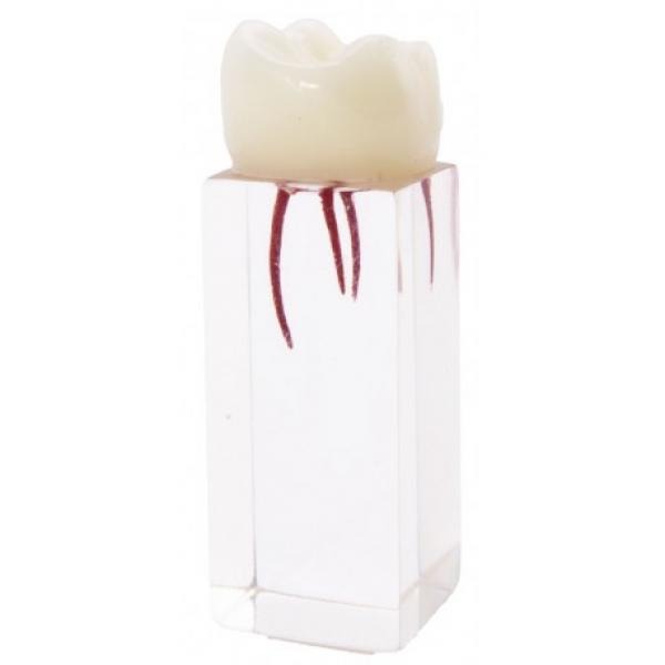 Molar for endodontics Img: 202008291