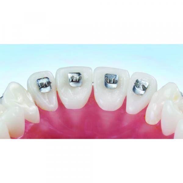 Protector to control Tongue Tamer habits (10u.) ORTHO TECHNOLOGY