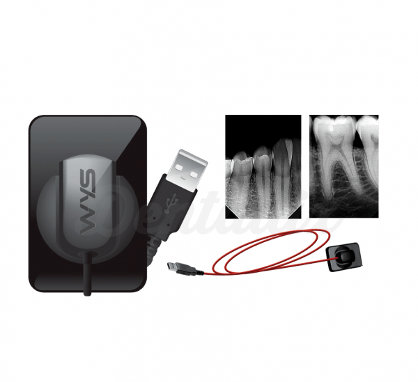 WYS Collector - USB CMOS Intraoral Radiology Sensor Img: 201905181