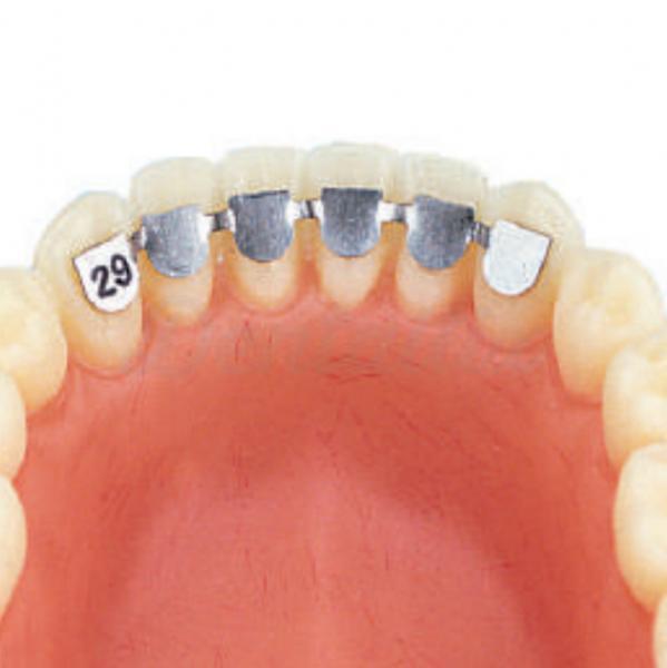 Assortment retainers lingual orthodontics (10pcs) Img: 201905251