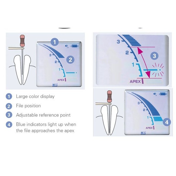 DENTAL  DentaPort Root ZX | MORITA