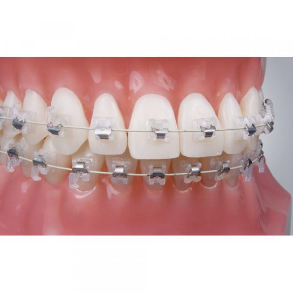 Selfligating Ceramic Bracket Roth 022 "Sensation (5u.) ORTHO TECHNOLOGY