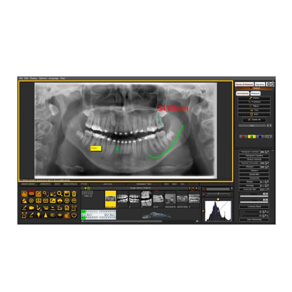Mediadent: Dental Image Management Software Img: 202107101