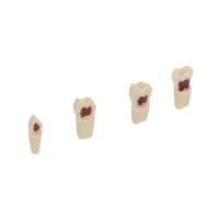 AK62Z: Model of Temporary Dental Pieces for Preparations (10ud) - AK62ZPUW - Nº55 - 10 Ud Img: 202503151