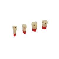 AG3ZSDPK.300V1: Permanent Dental Pieces For Preparations No.24 (10ud) - NR 24 - 10 Ud Img: 202503151 AG3ZSDPK.300V1: Permanent Dental Pieces For Preparations No.24 (10ud) - NR 24 - 10 Ud Img: 202503151