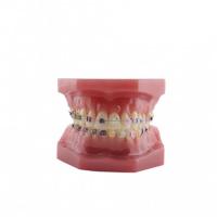 BADER BE BRACKET MODEL Img: 202109111