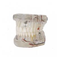 Nerve implant demonstration model Img: 202008291
