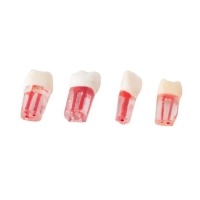 Set of Transparent Teeth with Ducts - Transparent hollows Img: 202312021