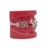 Model To Bracket Metallic And Sapphire Img: 202008291