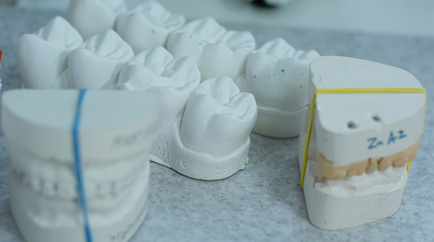 The perfect dental impression