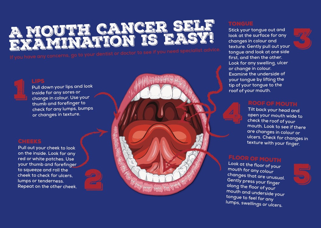 An Introduction To Oral Cancer Dental Supplies And Equipment