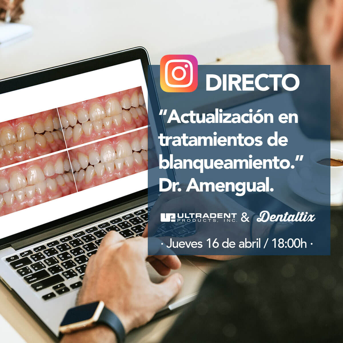 Charla en Instagram Direct