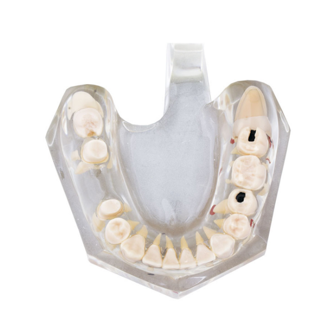MACROMODELO CON PATOLOGÍA COMPLETA  Img: 201905041