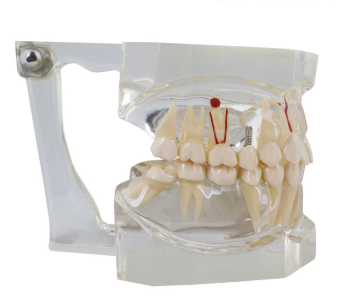 MACROMODELO CON PATOLOGÍA COMPLETA  Img: 201905041