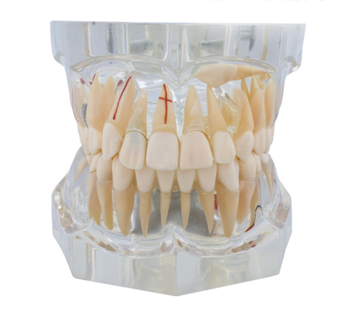 MACROMODELO CON PATOLOGÍA COMPLETA  Img: 201905041