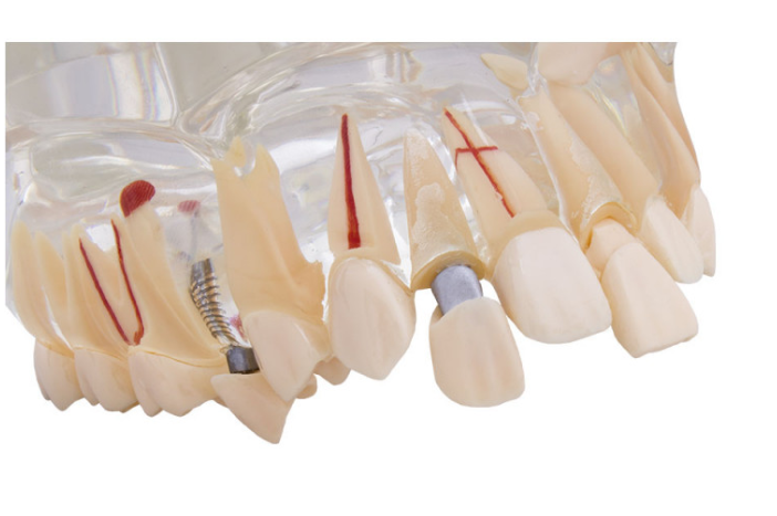 MACROMODELO CON PATOLOGÍA COMPLETA  Img: 201905041